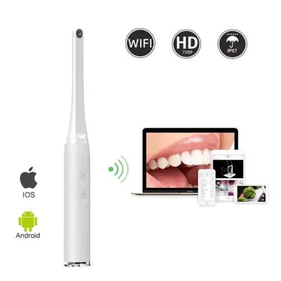 Endoscope Oral intra-oral