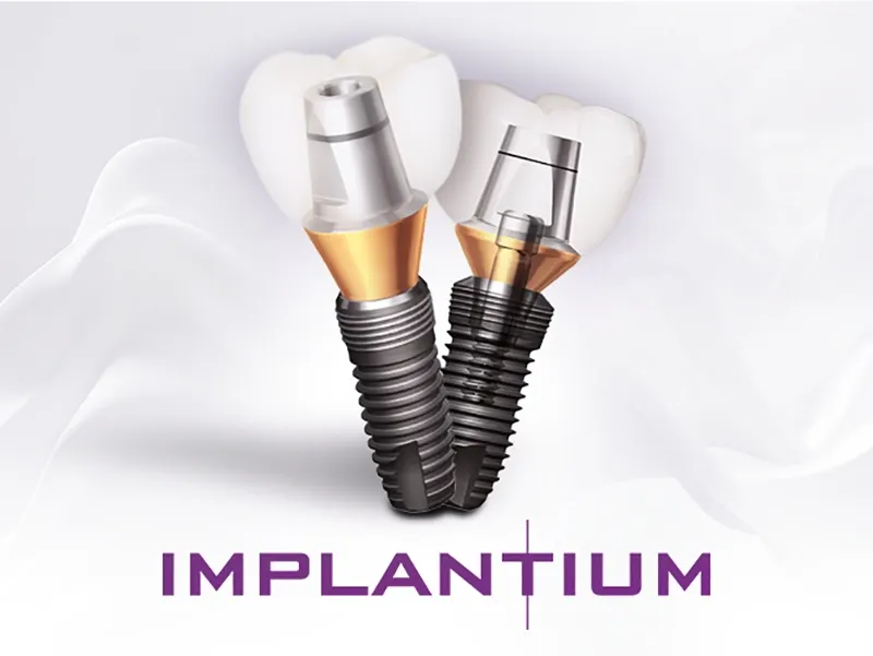 Implantium