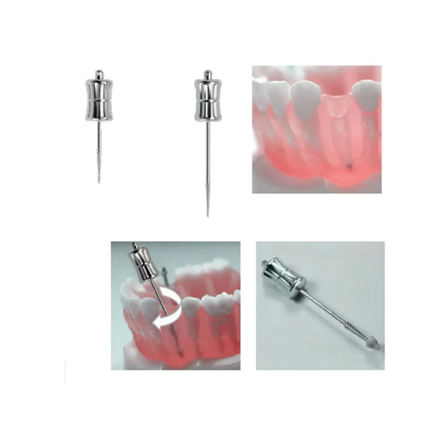 Screw extractors for root fragments, Medesy