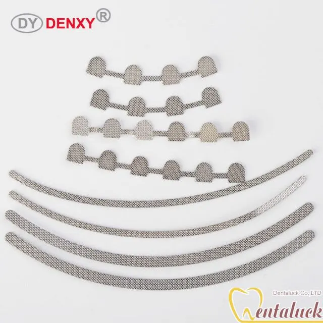 Thanh cố định mặt lưỡi Lingual Retainer