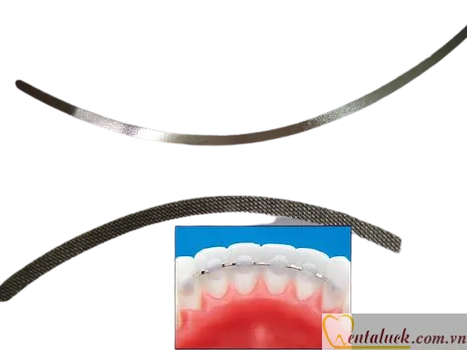 Dây bện cố định mặt lưỡi Lingual Retainer