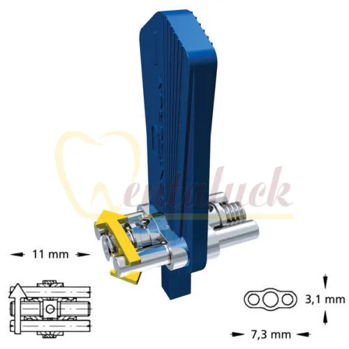 Ốc nong 2 chiều Dentaurum Medium 7,5mm