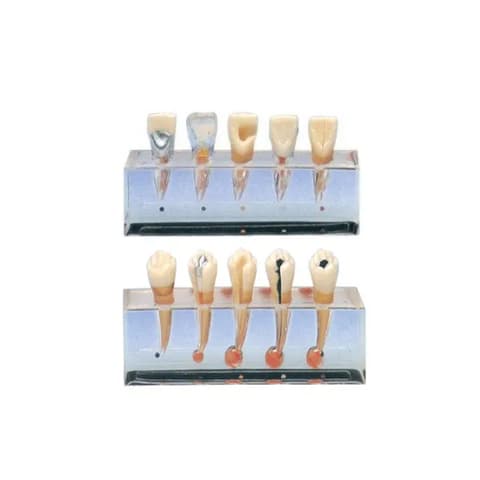 MediPros® RCT Sequence Model Anterior/Posterior
