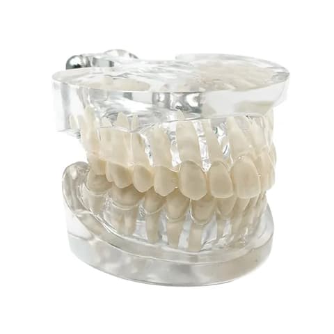 MediPros® Dental Standard Model With Removable Teeth