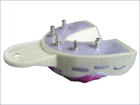 Miratray Implant Intro Kit
