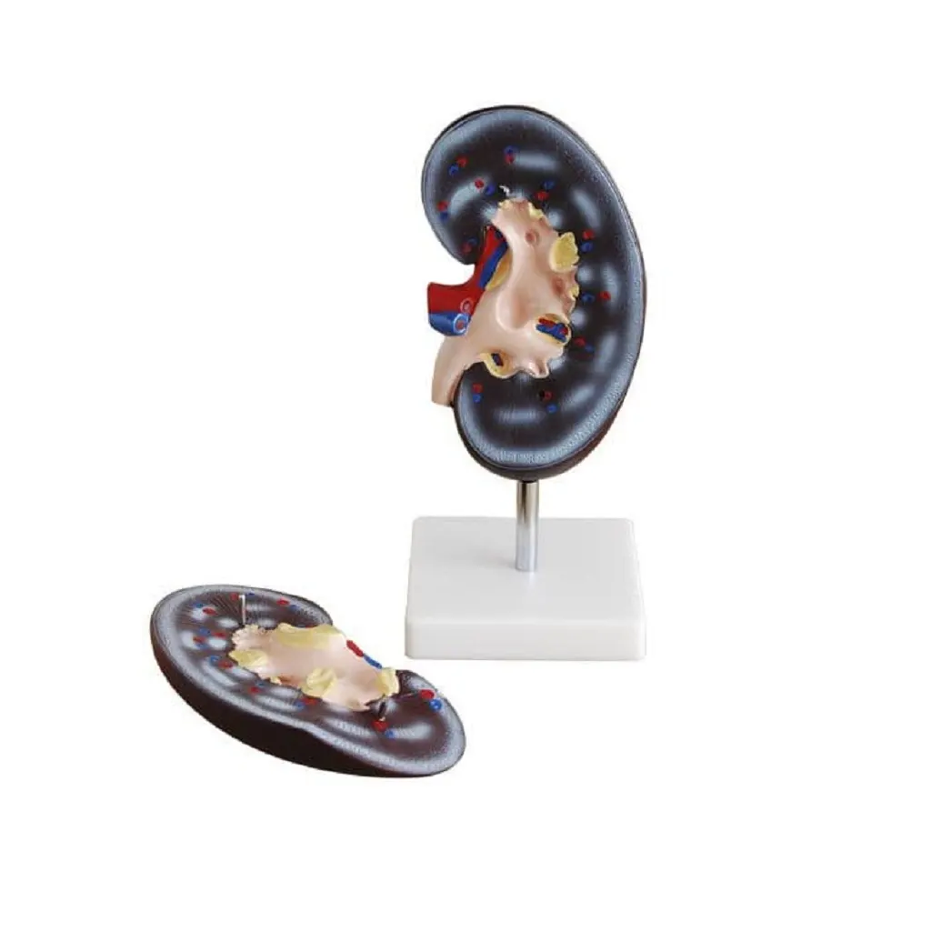 Kidney Model | مجسم كلية