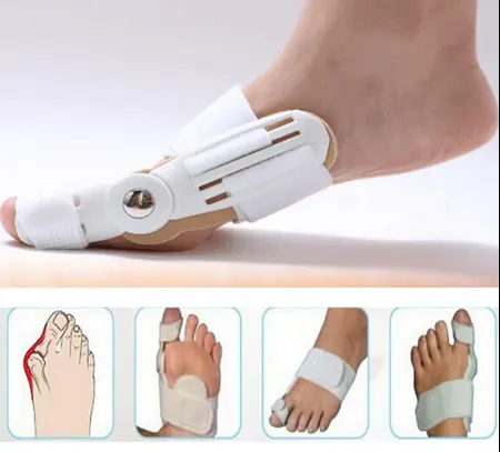 Hallux Valgus Splint | جبيرة مباعدة نهاري لاصبع القدم الافحج