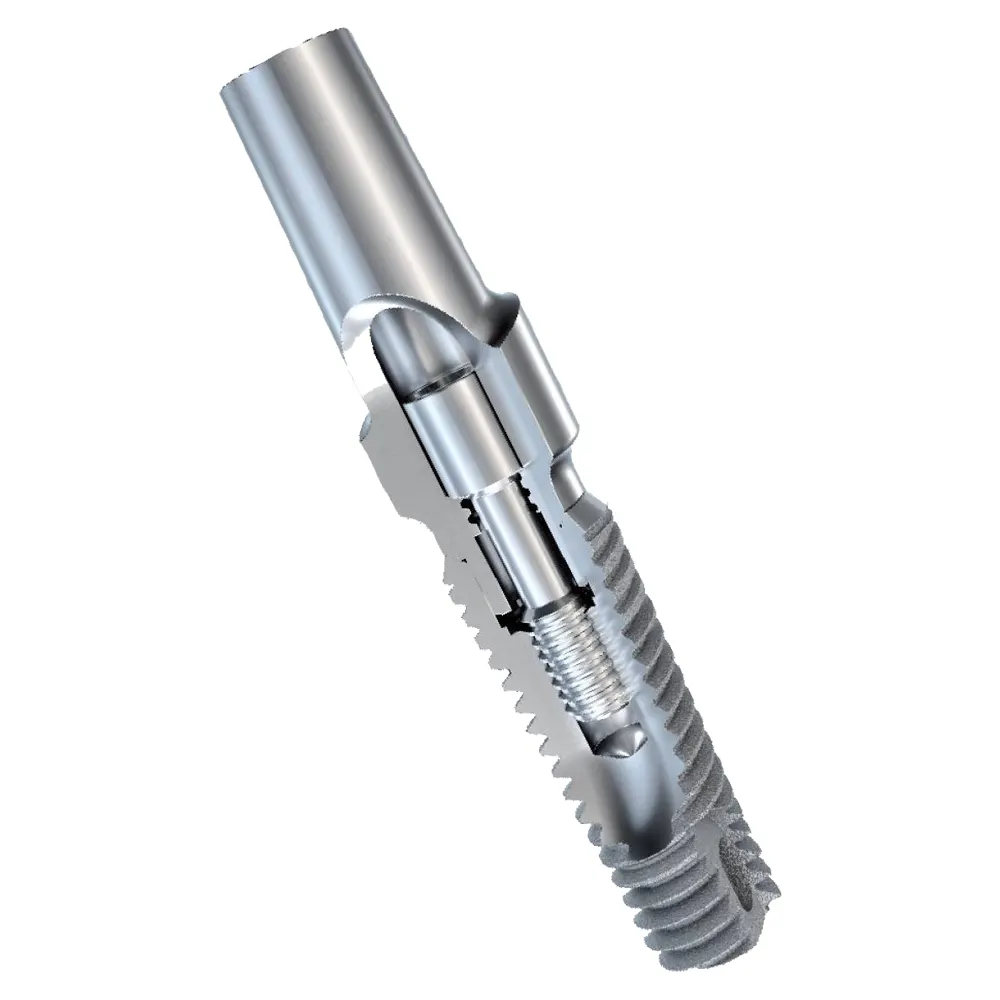 IMPLANT AU NIVEAU OSSEUX