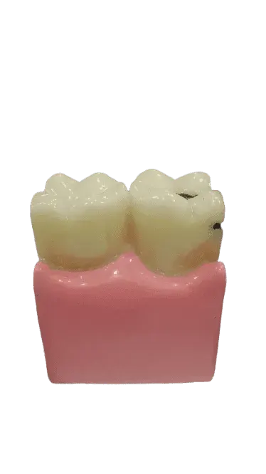 Study Model Molar Large Pink