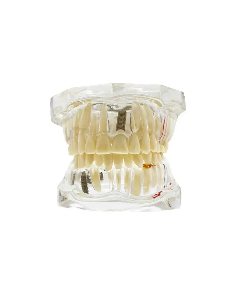 Study Model – White