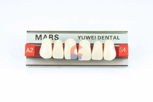 MARS Pontics S4 A2
