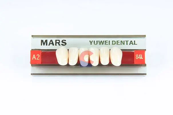 MARS Pontics S4L A2
