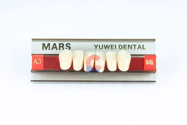 MARS Pontics S4L A3