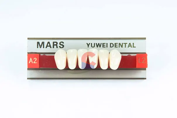 MARS Pontics L2 A2