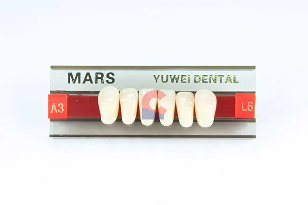 MARS Pontics L6 A3
