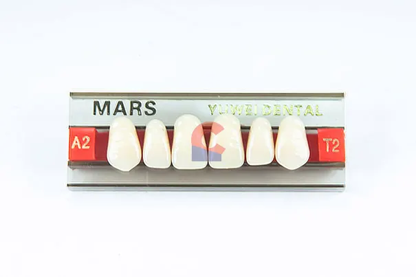 MARS Pontics T2 A2
