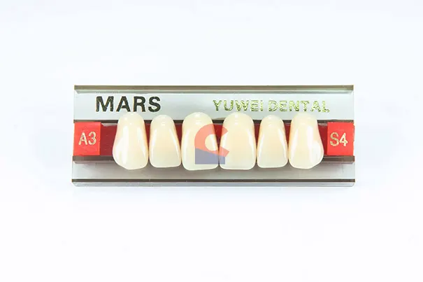 MARS Pontics S4 A3
