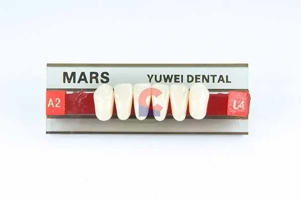 MARS Pontics L4 A2