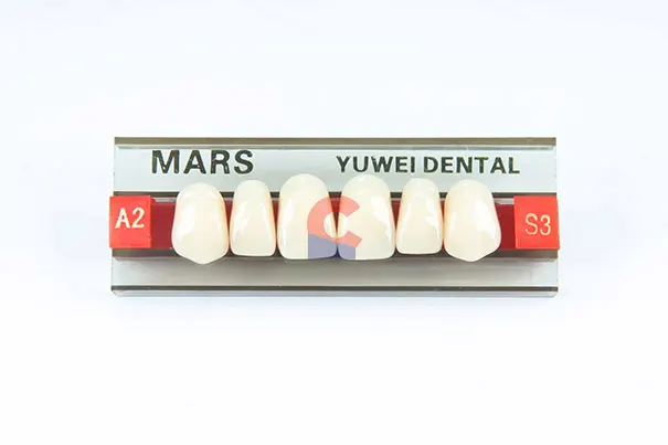 MARS Pontics S3 A2 1