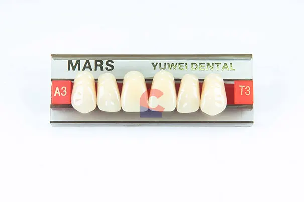 MARS Pontics T3 A3