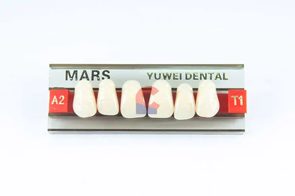 MARS Pontics T1 A2