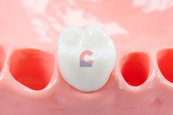 Nissin Typodont 26