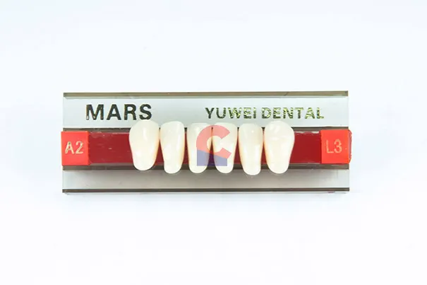 MARS Pontics L3 A2