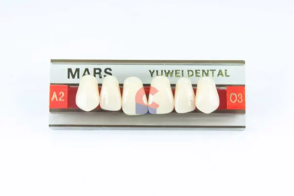 MARS Pontics O3 A2