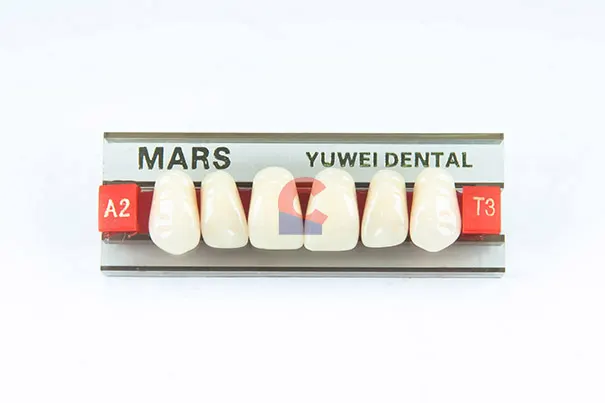 MARS Pontics T3 A2