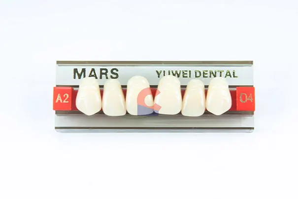 MARS Pontics O4 A2