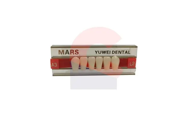 MARS Pontics L2 A3