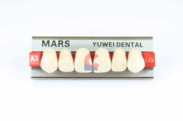 MARS Pontics O5 A3