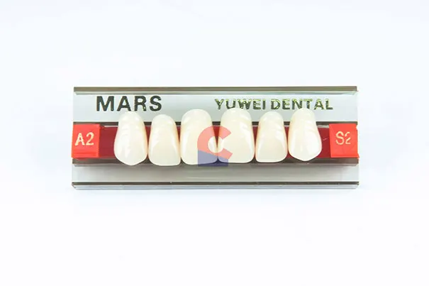 MARS Pontics S2 A2