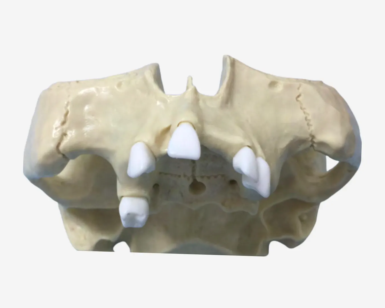 SINUS LIFT MODELS – DM 134