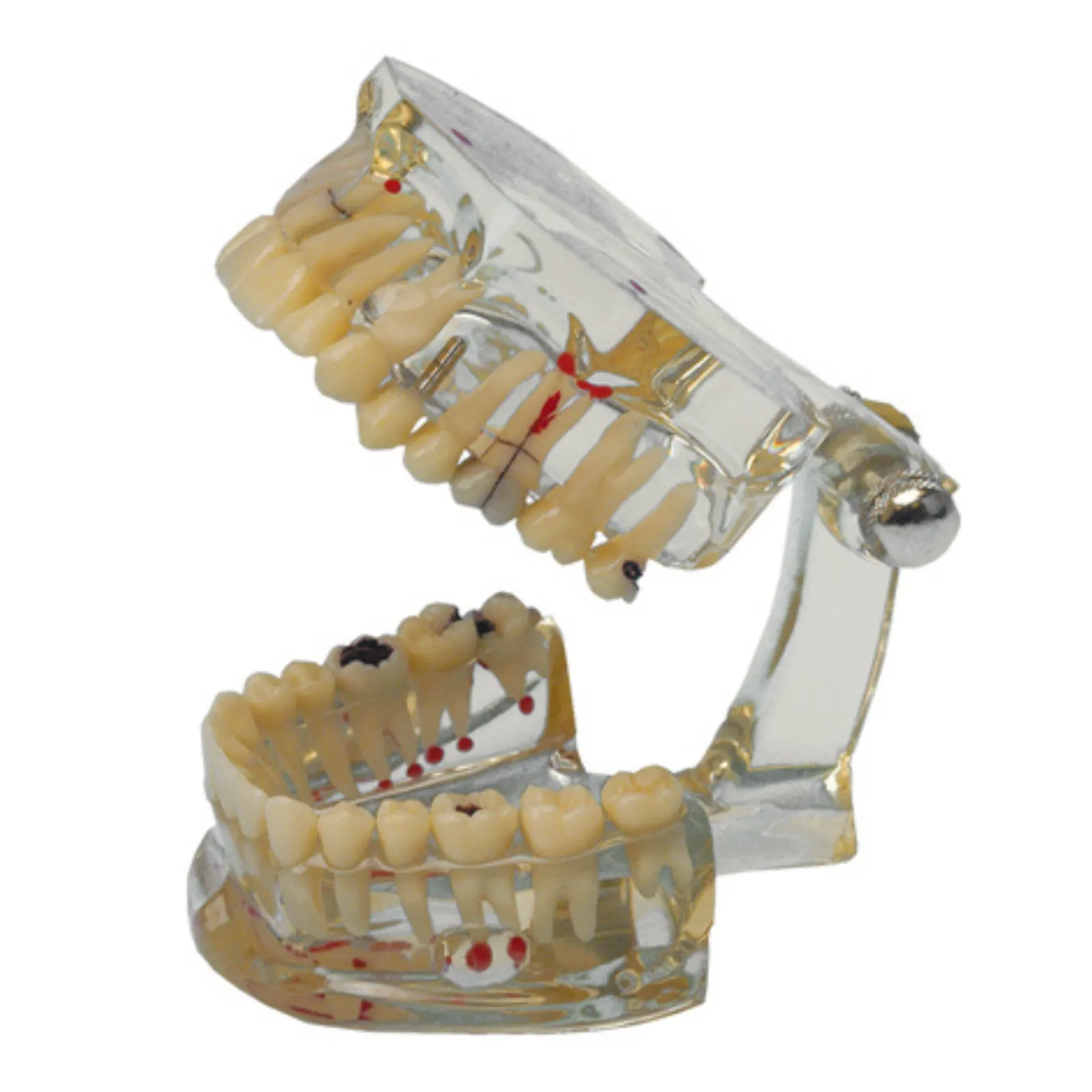 Study Model Transparent Plus | 355640