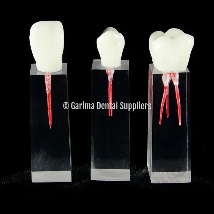 JM Filled Extended Root Canalk W/ Crown