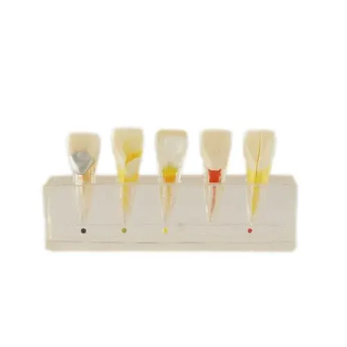 HST Pulp Disease Study Model – L3B