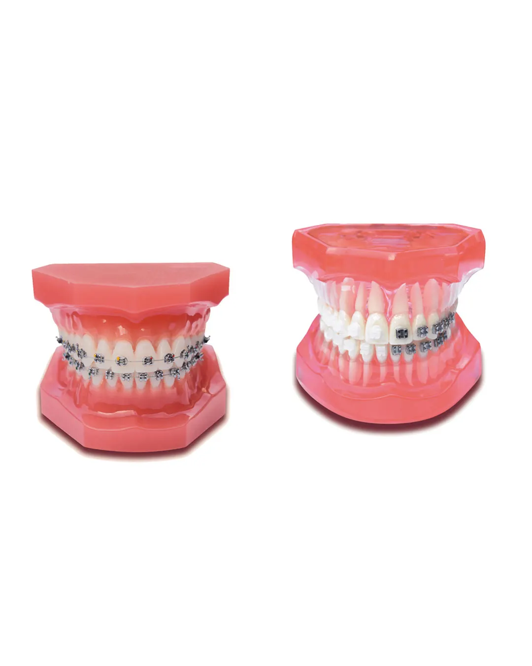 Modèles d’orthodontie