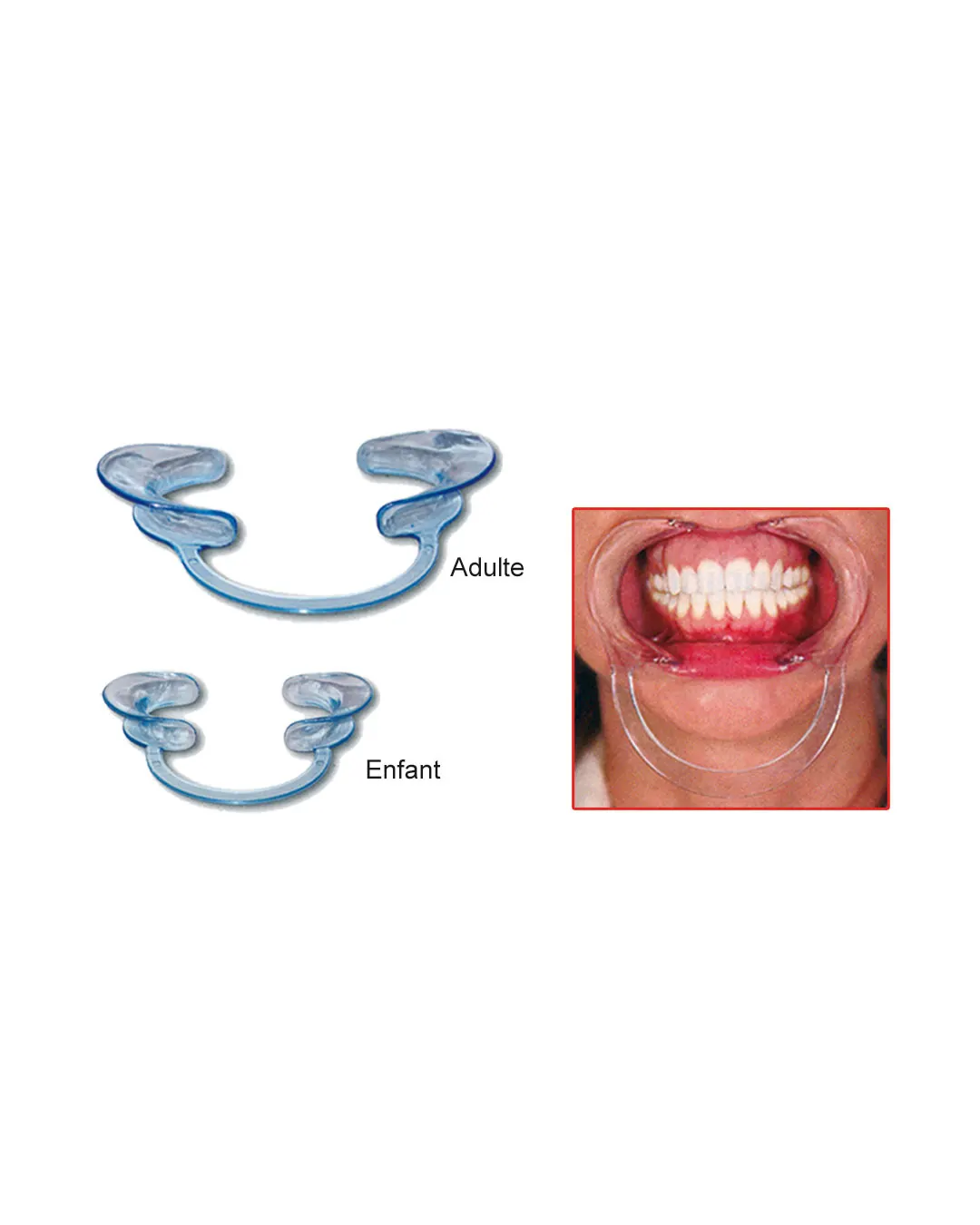 Ecarte-lèvres universselle : DENTAL PACIFIC