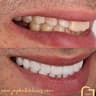 Joy Dental Center Nasr City مركز چوي لزراعة وتجميل الأسنان مدينة نصر – Nasr City