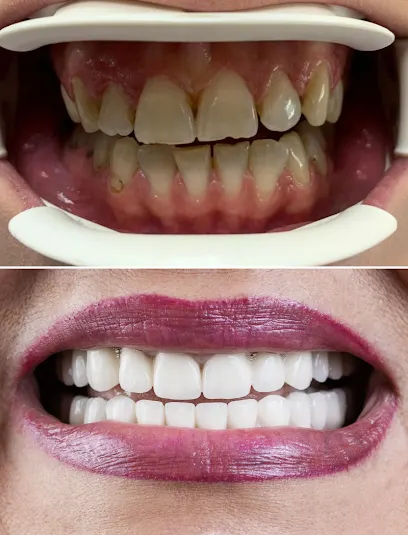 Belgrade Dental Tour - (Dental Tourism, Dental clinic in Belgrade Serbia) – Belgrade