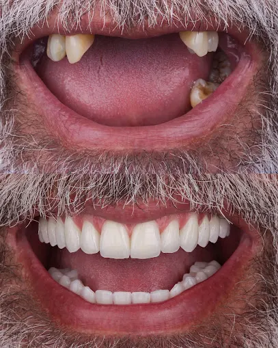 Oralfy Belém | Implante | Invisalign | Dentista em Belém – Belém