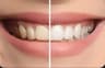 عيادة د.منى نادى تجميل و زراعه الاسنان Smile Avenue Clinic Dr.Mona Nady – Haram