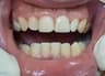مركز الدكتور إسلام جمعة لزراعة وتجميل الأسنان – Asyut