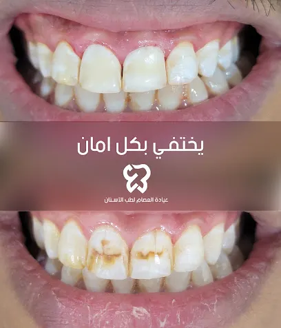 مركز العصام لطب الأسنان – عدن