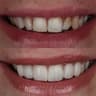 Blueberry Microscopic Dental Clinic _ Hurghada – Hurghada