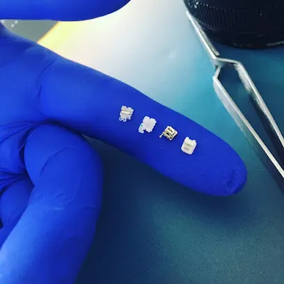 Dr.Dt.Enver Akın Özkan Ankara Ortodonti Uzmanı, Ankara Diş Teli, Ankara Invisalign Şeffaf Plak Tedavisi , Ankara Orthodontist – Çankaya