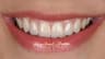 Dr Ahmed Ibrahim Dental clinic – Nasr City