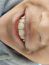 عيادة الدكتور باسم ابراهيم ابو دقيقة اخصائي طب الفم والاسنان – إيتاى البارود
