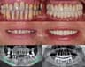 Shalash Dental Center-Dr. Mahmoud Shalash – Maadi